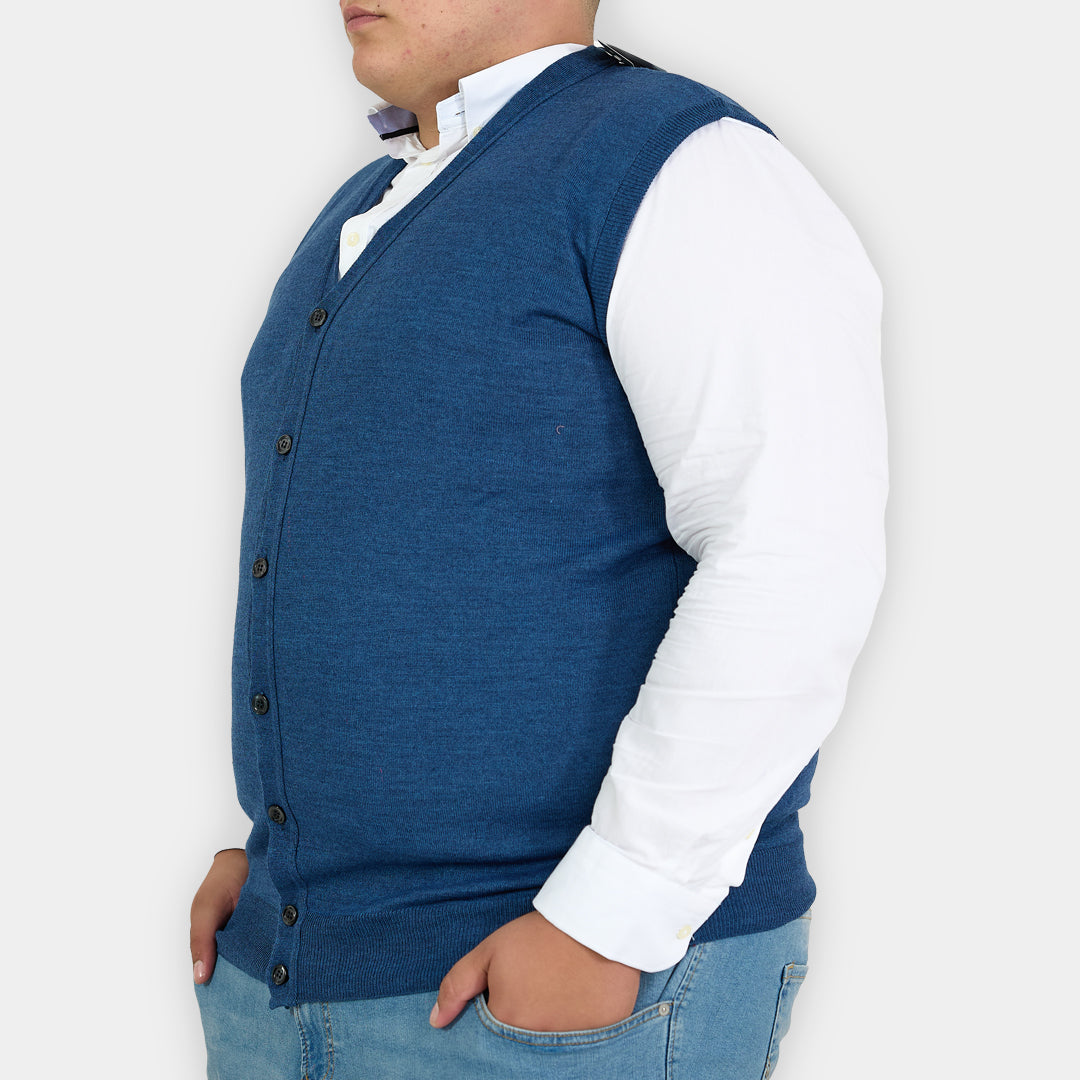 Gilet con Bottoni